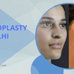 Rhinoplasty in Delhi