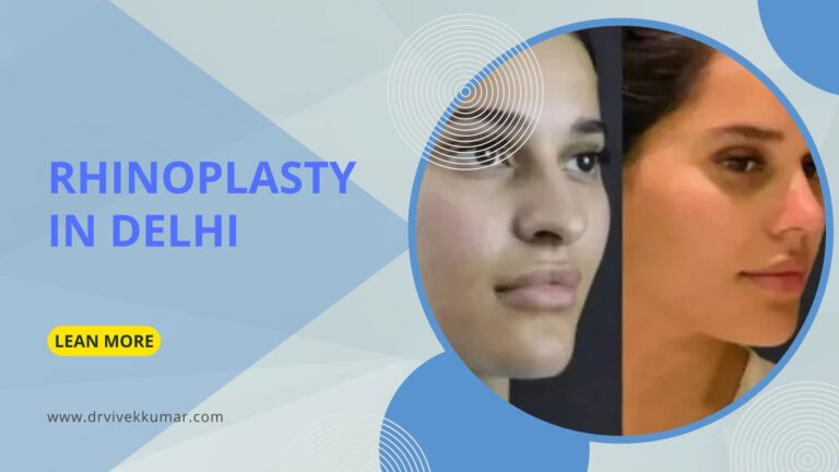 Rhinoplasty in Delhi